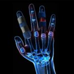Adjustable Finger Splint Brace Fracture Trigger Fingers Protector Pain Relief AU - Image 5