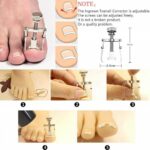 12Pcs Ingrown Toenail Treatment Tool Foot Pedicure Household Nail Clipper Set AU - Image 2