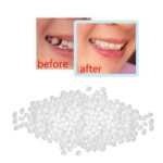 10~100g Tooth Repair Granules Temporary Kit Fitting Beads Reusable False Teeth - Image 5