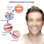 4x Mouth Guard Night Bruxism Clenching Teeth Grinding Mouthguard Sleeping Dental - Image 3