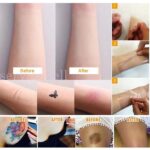 5PCS Tattoo Scar Acne Cover Cover Up Sticker Birthmark Waterproof Hide Tape - Image 7