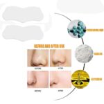 Blackhead Remover Nose Face Mask Strips x10 Black Head Pore Acne Clean - Image 2