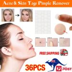 36/108pcs Skin Tag Remover Acne Pimple Patch Removal Facial Care Spot Plaster AU - Image 2