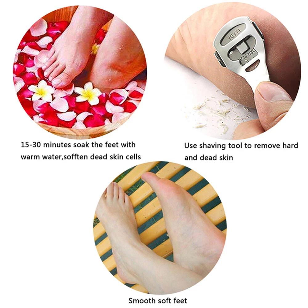 Foot Care File Pedicure Kit Callus Remover Feet Hard Dead Skin +10 accessory - Image 3
