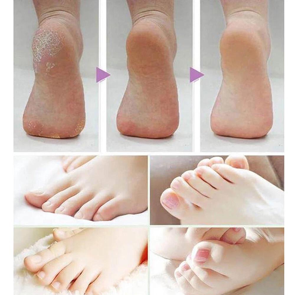 PCS Velvet Smooth Express Pedi Foot File Roller Head Refills For Scholl - Image 6